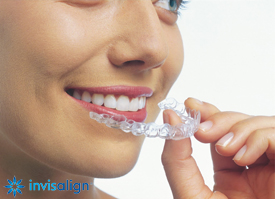 Invisalign Clear Braces